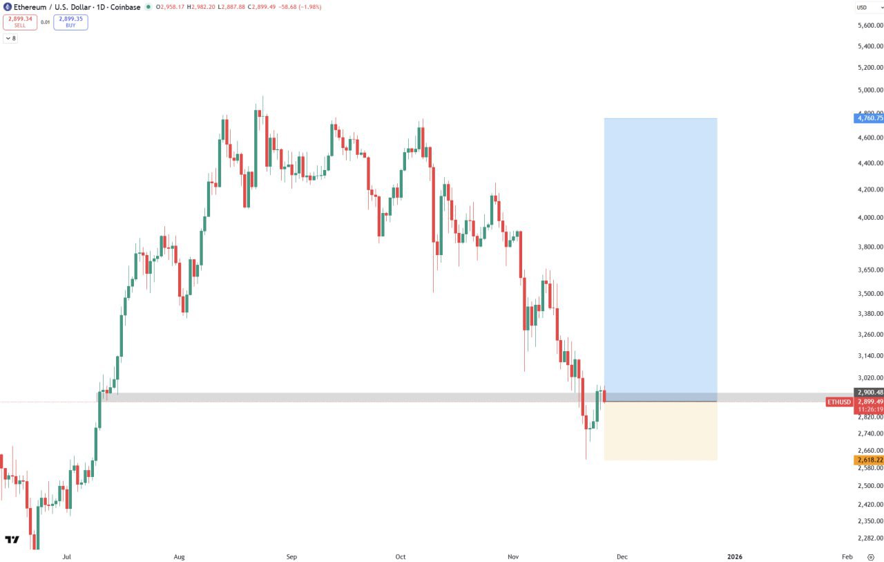 ETH Bullish — Short Market Note on Ethereum Upside